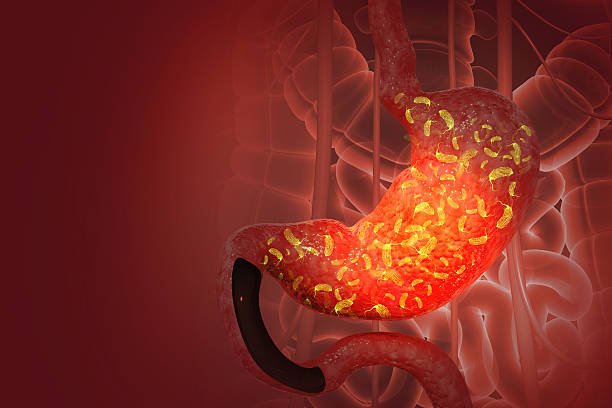 istock Viral gastroenteritis (stomach flu). human digestive system infected by virus or bacteria. 3d illustration 2241184848