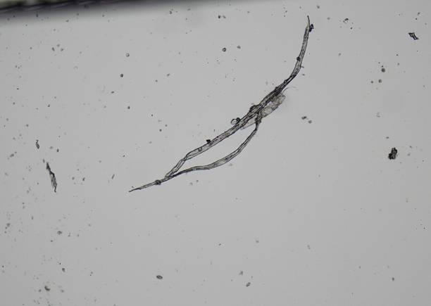 istock soil microorganisms under a microscope including amoeba, flagellates, nematodes, fungi, bacteria 2241286944