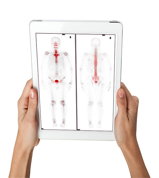 istock Hand interacting with tablet displaying PET  CT scans. Multiview diagnostic imaging highlights abnormal metabolic activity. Ideal for medical, oncology, and tech-related visuals. 2241511029