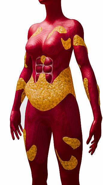 Fat Loss Process in Abdominal Area Highlighting Visceral and Subcutaneous Fat in Human Body for Health Education 3D Rendering