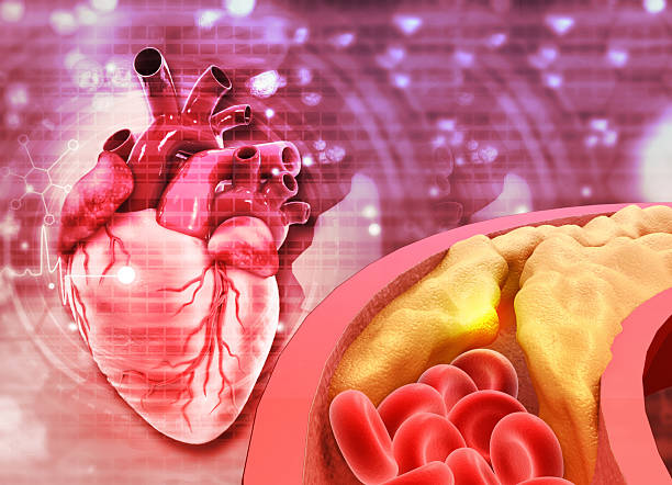istock Human heart with Blocked blood vessel, cholesterol blocking artery 2241767448