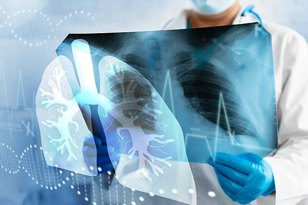 istock Medical professional examines lung x-ray in clinic setting during daytime for patient analysis 2242131294