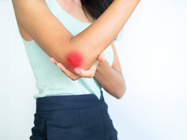 istock Elbow pain woman 2242310189