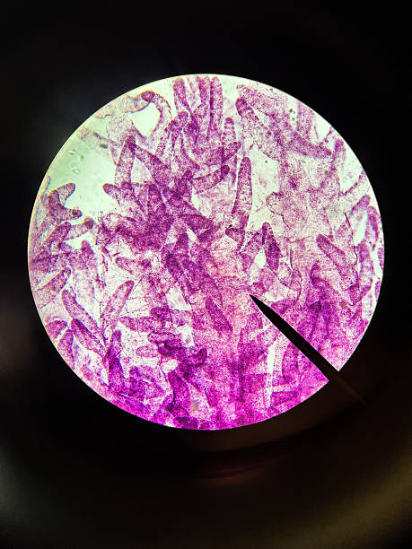 Alcyonacea Octocorallia Polyp Pinnules under Microscope in Zoology, Biology research laboratory.  The pink-stained structures are arranged within a circular field of view, typical of a microscope lens, against a dark background. Ideal for educational material, scientific research, or visual representations of biology and histology.