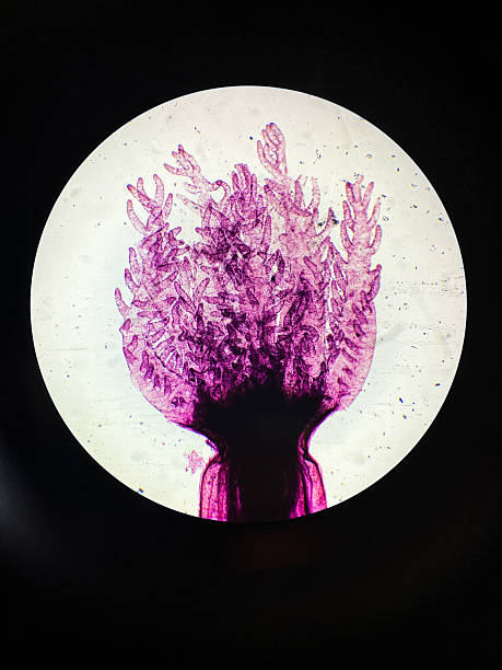 Alcyonacea Octocorallia Polyp Pinnules under Microscope in Zoology, Biology research laboratory.  The pink-stained structures are arranged within a circular field of view, typical of a microscope lens, against a dark background. Ideal for educational material, scientific research, or visual representations of biology and histology.