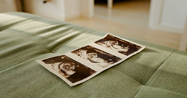 istock Ultrasound small three baby photos isolated on the sofa. 2242606349