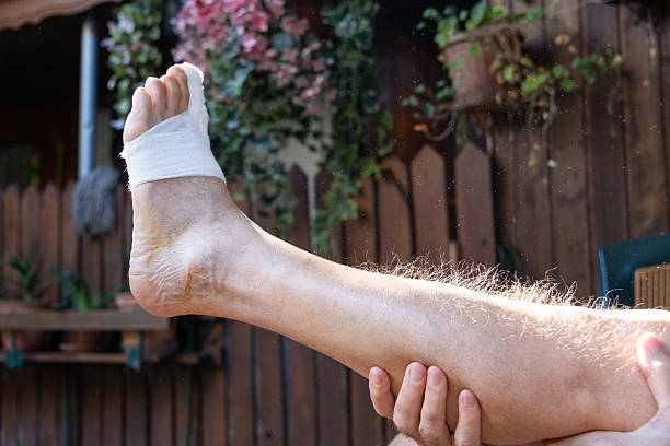 Doc reviewing foot surgery, capsulotomy, scarf type osteotomy, Hallux Valgus correction, Akin osteotomy with saw, Weril type osteotomy. Claw deformity of the fingers with plantar and dorsal keratosis
