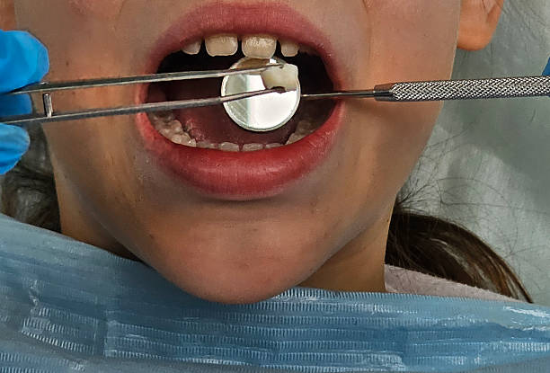 Child receiving dental care with tools in a clinic setting during a routine examination