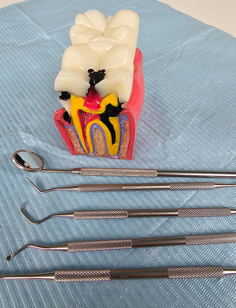 istock Educational dental model with instruments on blue surface used for a dental 2243119605