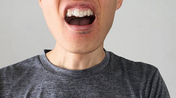 istock A person wearing an orthodontic mouthpiece 2243134488