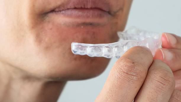 istock A person removing a mouthpiece from their teeth 2243134501