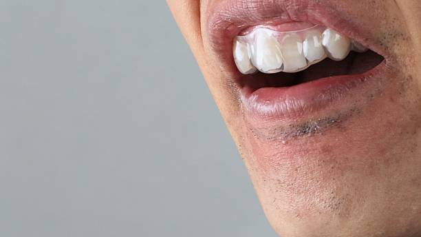 istock A person wearing an orthodontic mouthpiece 2243134523