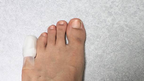 istock Foot with injured little toe 2243134606