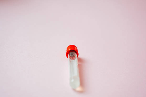 A test tube that features a bright red cap is carefully placed on a soft pink surface, highlighting its vibrant color beautifully, while it creates a striking contrast with the background