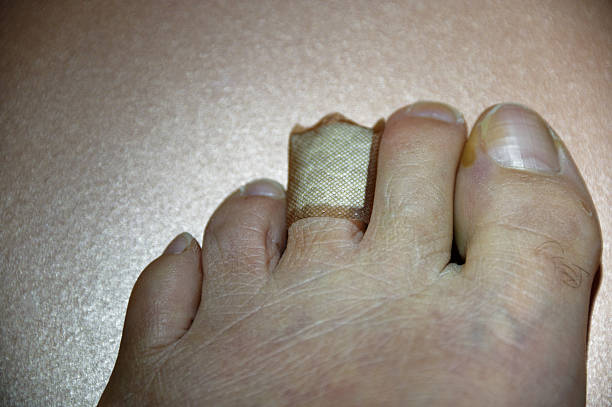 An injured toe is protected by a piece of sticking plaster