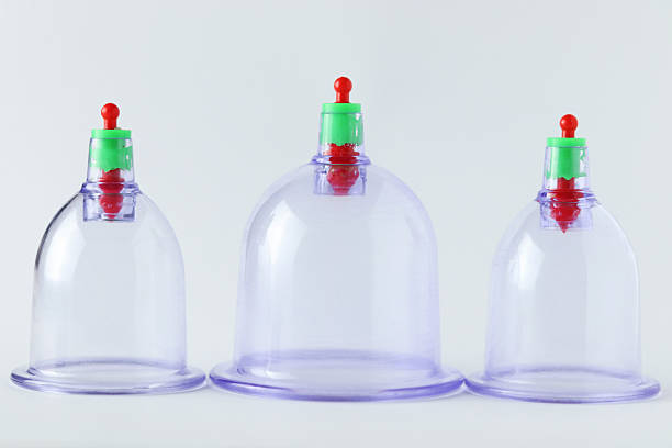 A set of three plastic cupping therapy cups in different sizes, with colorful green and red tops. These cups are used for suction therapy, offering an alternative method for pain relief and relaxation.