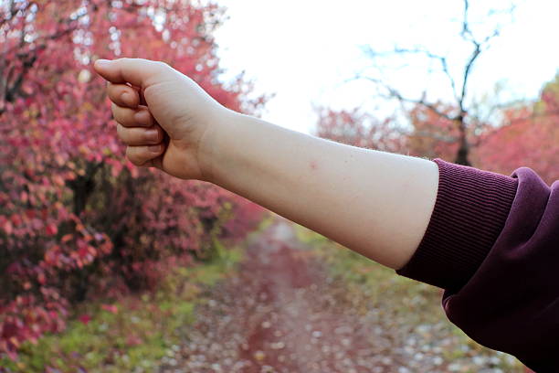 Person’s arm extended forward, pointing toward colorful autumn trees in a park, with a visible insect bite on the skin and warm natural light highlighting the fall foliage.