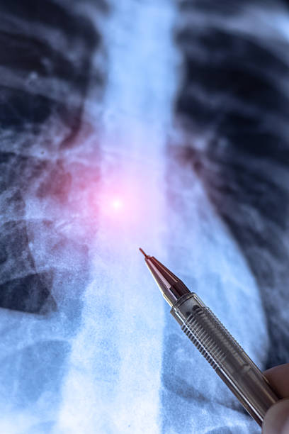 Doctor learning vertical X-ray of humans chest and inside soft tissues.