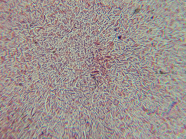 Dense Clumps of Rod-Shaped Bacteria (Bacilli) Under a Microscope