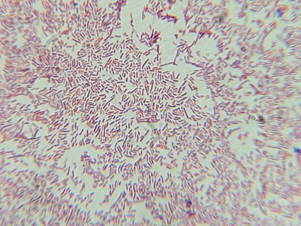 Dense Clumps of Rod-Shaped Bacteria (Bacilli) Under a Microscope