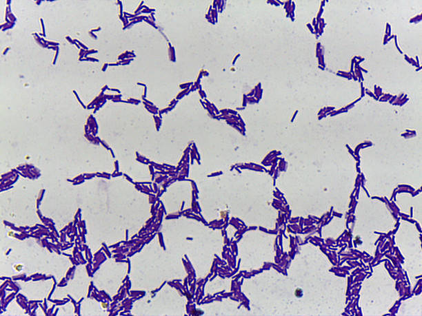 istock Microscopic Field of Purple Bacilli Showing Chains and Clump 2243844188