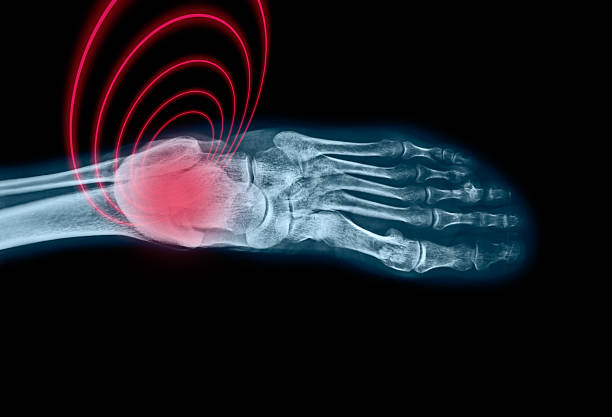 X-ray of a human female foot, ankle and lower leg