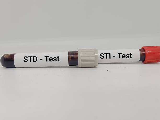 istock Blood sample for STI  and SDT Test. 2244094529