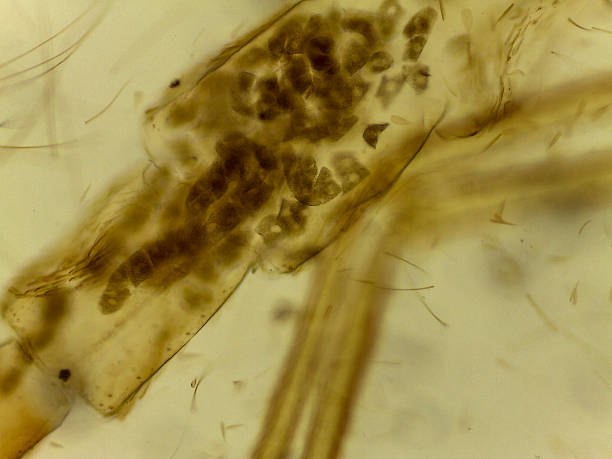 istock Microscopic Morphology of Culex pipiens Mosquito Larval or Pupal Head Capsule and Appendage 2244142903