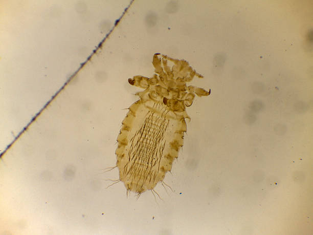 istock Microscopic view of human louse showing detailed body struct 2244143914