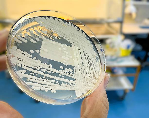istock Candida auris on Sabouraud Agar – Emerging Hospital Superbug 2244456930