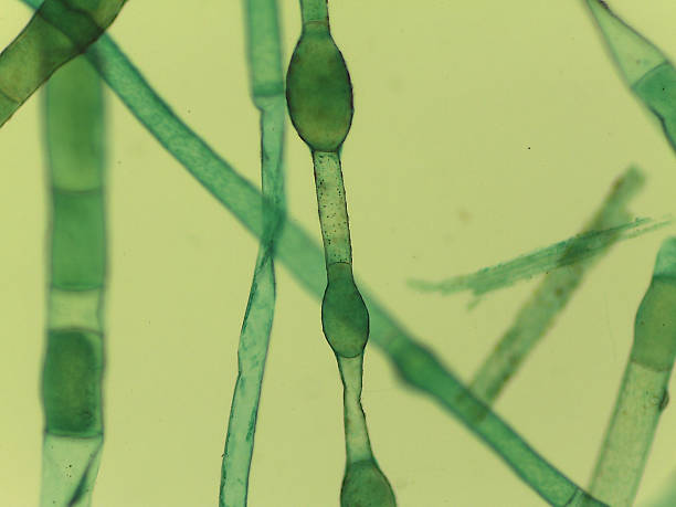 istock Microscopic View of the Filamentous Green Algae, Pithophora, Showing Akinet 2244519788