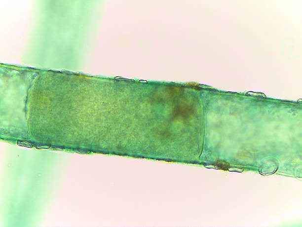 istock Microscopic View of the Filamentous Green Algae, Pithophora, Showing Akinet 2244520391