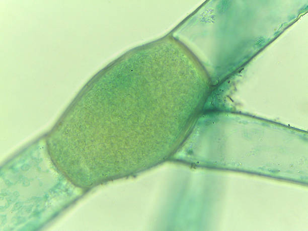istock Microscopic View of the Filamentous Green Algae, Pithophora, Showing Akinet 2244520401