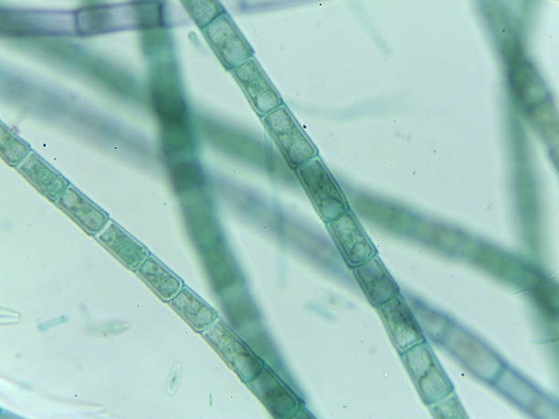 istock Microscopic View of Filamentous Algae (Oedogonium) with Potential Dwarf Male Filame 2244520925