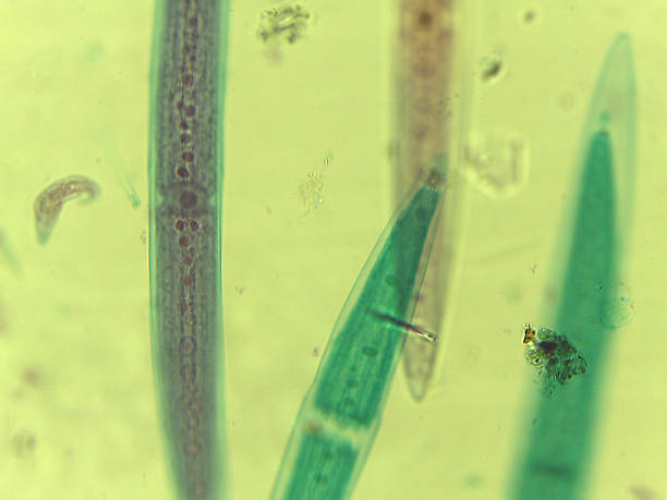 istock Microscopic Field of Crescent-Shaped Green Algae (Closterium) Filament 2244523005