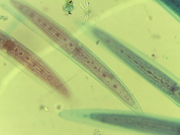 istock Microscopic Field of Crescent-Shaped Green Algae (Closterium) Filament 2244523033