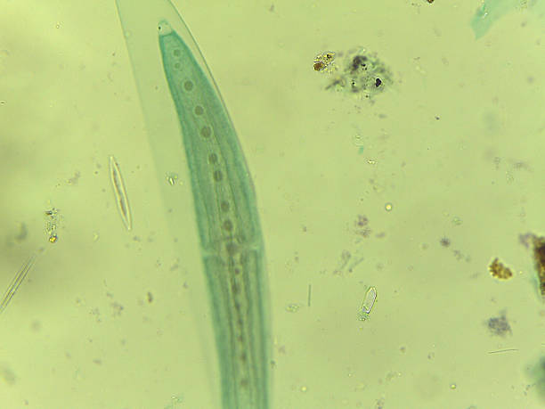 istock Microscopic Field of Crescent-Shaped Green Algae (Closterium) Filament 2244523126