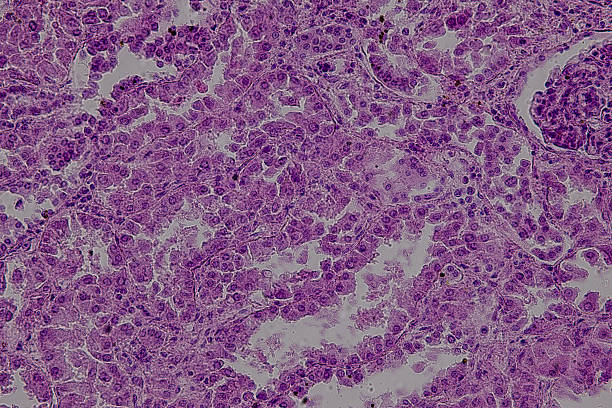 istock Pathology and Histology Tissue of Mammals under microscope. 2245232397