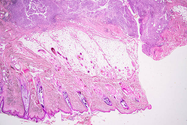 istock Pathology and Histology Tissue of Mammals under microscope. 2245232437