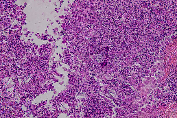 istock Pathology and Histology Tissue of Mammals under microscope. 2245232439