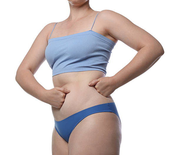 istock Liposuction. Woman in underwear on white background 2245355663