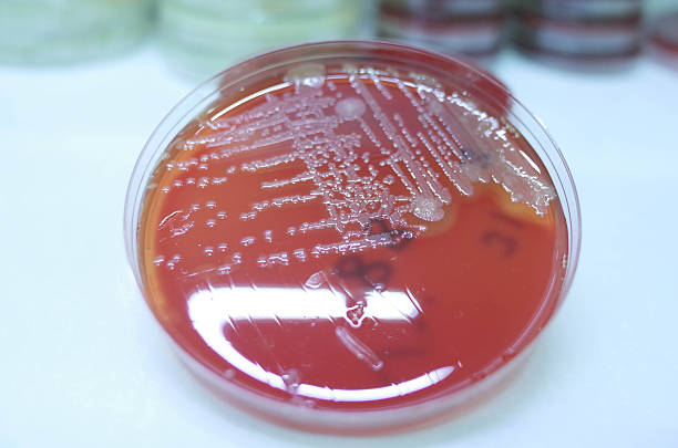 istock Bacterial growth in a petri dish on red agar 2245400008