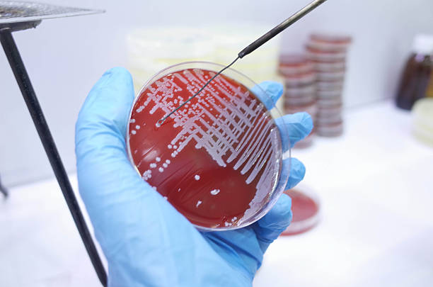 A scientist holding a petri dish with bacterial cultures, wearing blue gloves, in a laboratory setting