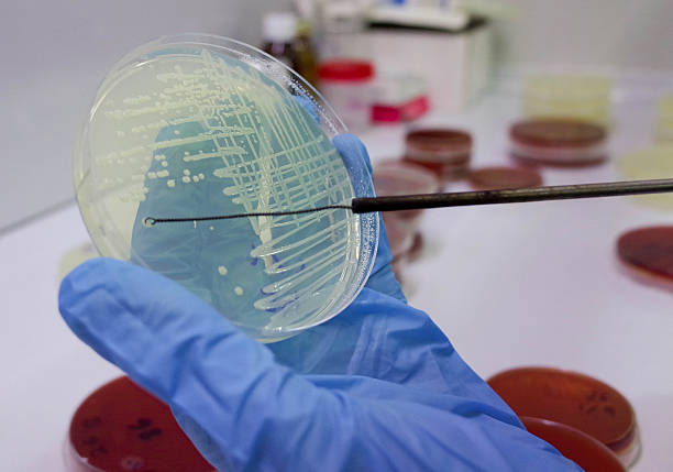 istock Scientist Examining Bacterial Colonies in Petri Dish 2245400111