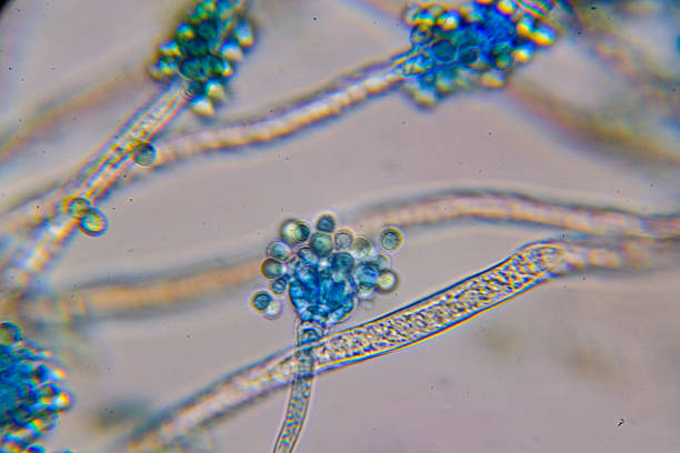 Aspergillus (mold) under the microscopic view for education.