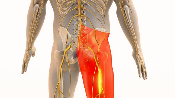 istock Painful Sciatic Nerve Sensation in Lower Body 2245604206