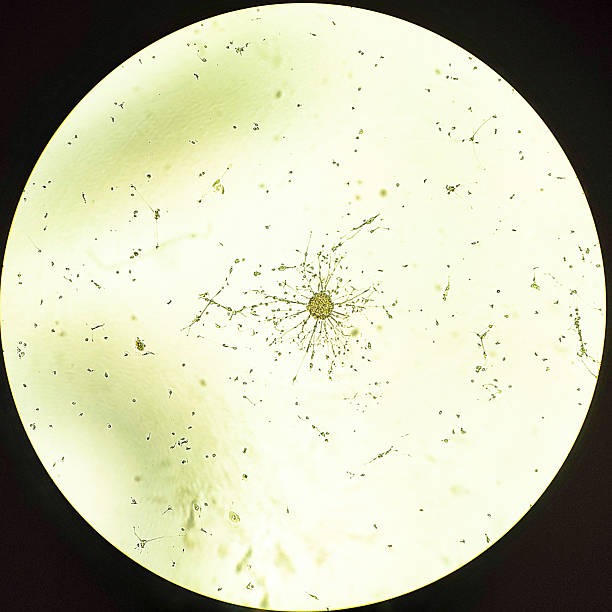istock Glioblastoma cell spheroids. 2245781775