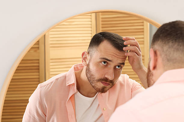 istock Baldness problem. Man with receding hairline near mirror at home 2245817123