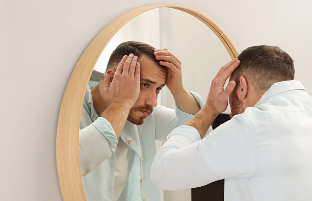 istock Baldness problem. Man with receding hairline near mirror at home 2245817125