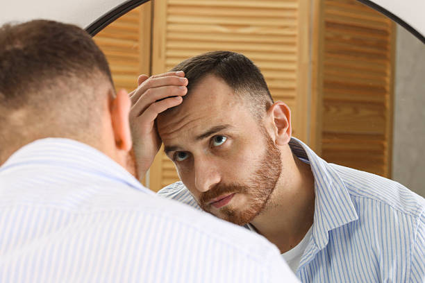 istock Baldness problem. Man with receding hairline near mirror at home 2245817162